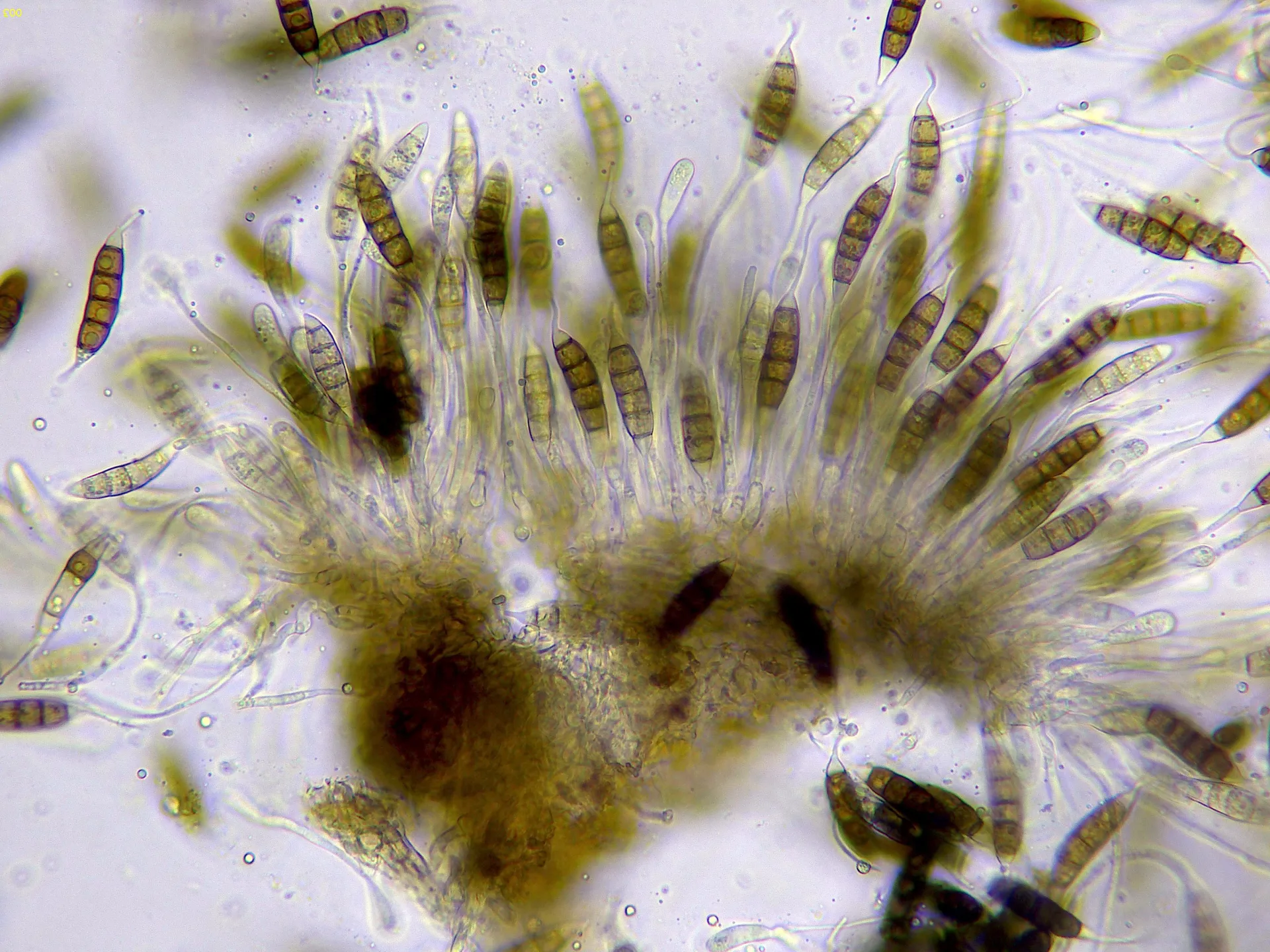 Microscopía de Seiridium marginatum - 11 - Himenio x 400-003